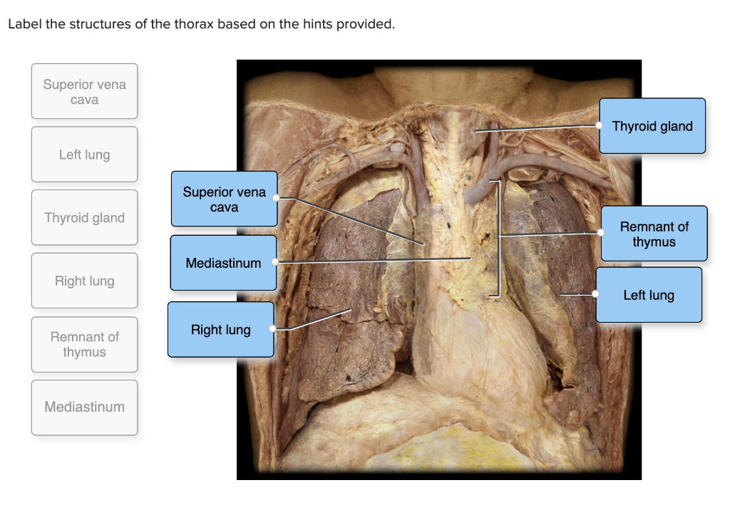 Solved Label the structures of the thorax based on the hints