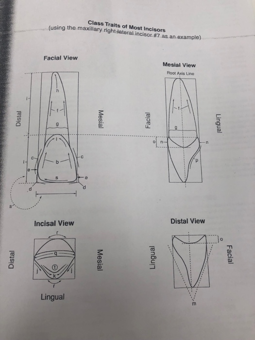Solved Class Traits of Most Incisors (using the maxillary