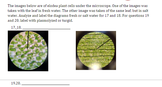 elodea cells under a microscope