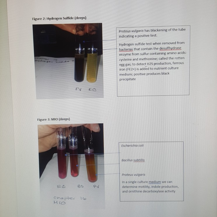 Solved LAB 16 Protein catabolism, Part 2 PURPOSE To be