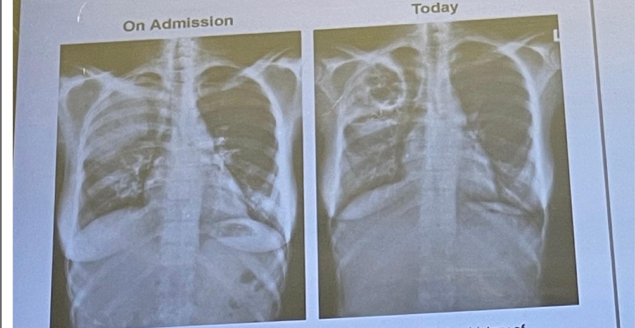 Solved A 52-year-old woman is brought to the physician | Chegg.com