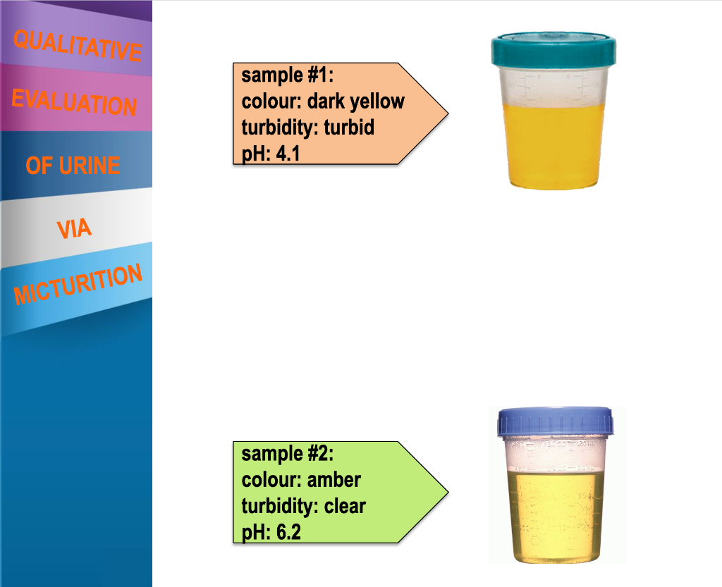 Solved sample \#1: colour: dark yellow turbidity: turbid pH: | Chegg.com