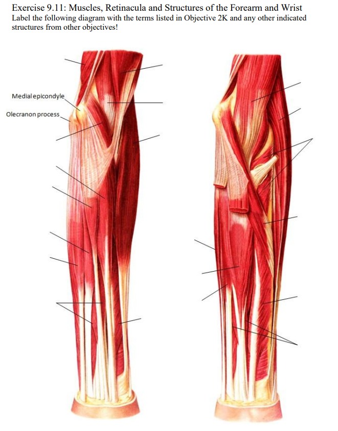 Exercise 9.11: Muscles, Retinacula and Structures of the Forearm and Wrist