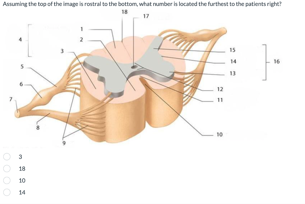Solved Assuming the top of the image is rostral to the | Chegg.com