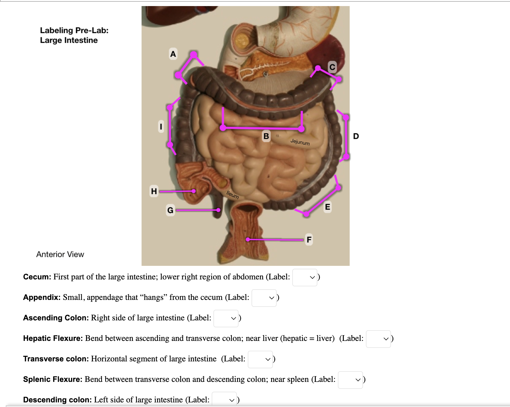 Solved Labeling Pre-Lab: Large Intestine J Anterior View | Chegg.com