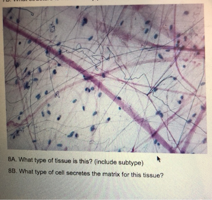 Solved 8A. What type of tissue is this? (include subtype) | Chegg.com