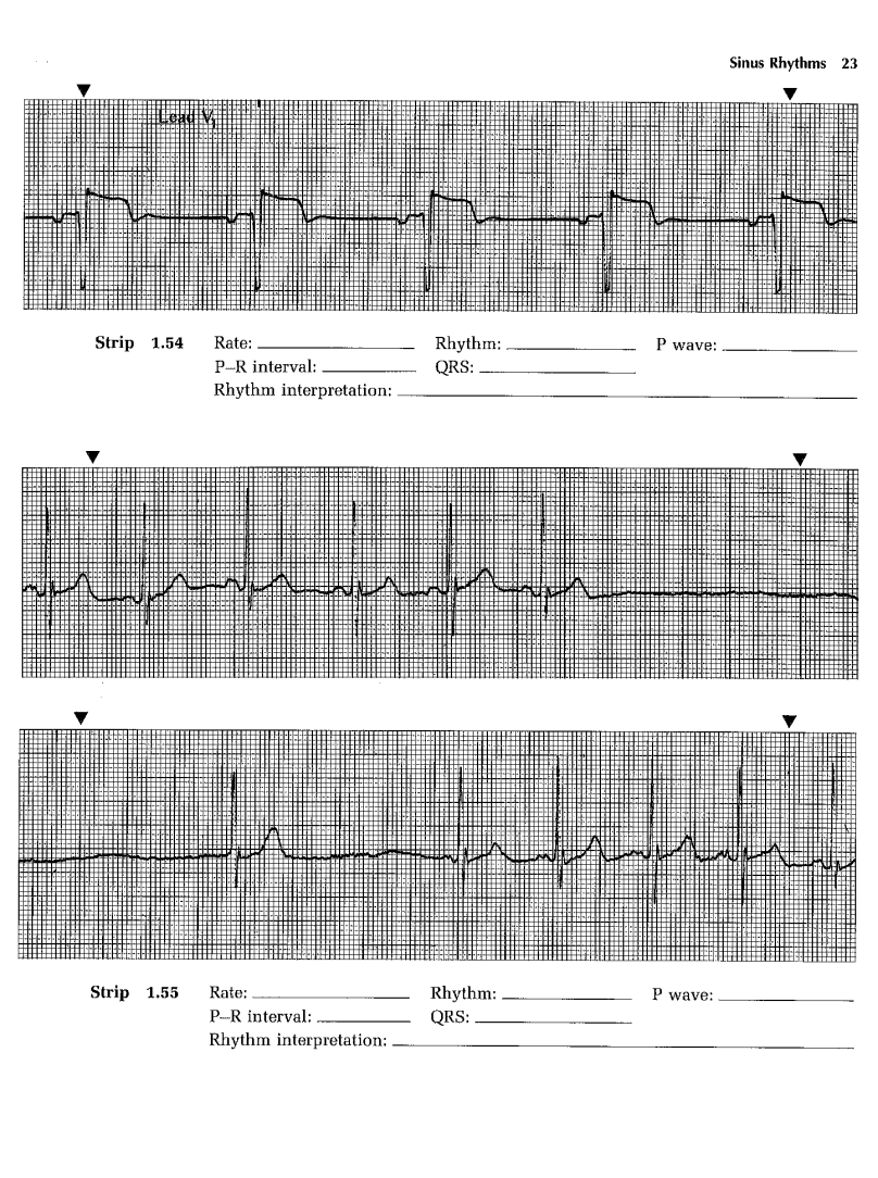 Solved Strip 1.48 Rate: Rhythm: P wave: P−R interval: QRS: | Chegg.com