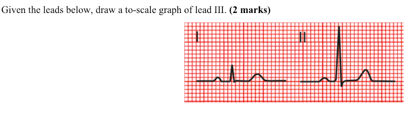 Solved Given the leads below, draw a to-scale graph of lead | Chegg.com
