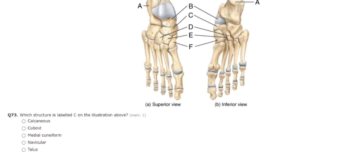 Solved A- B D E F (a) Superior view (b) Inferior view Q73. | Chegg.com