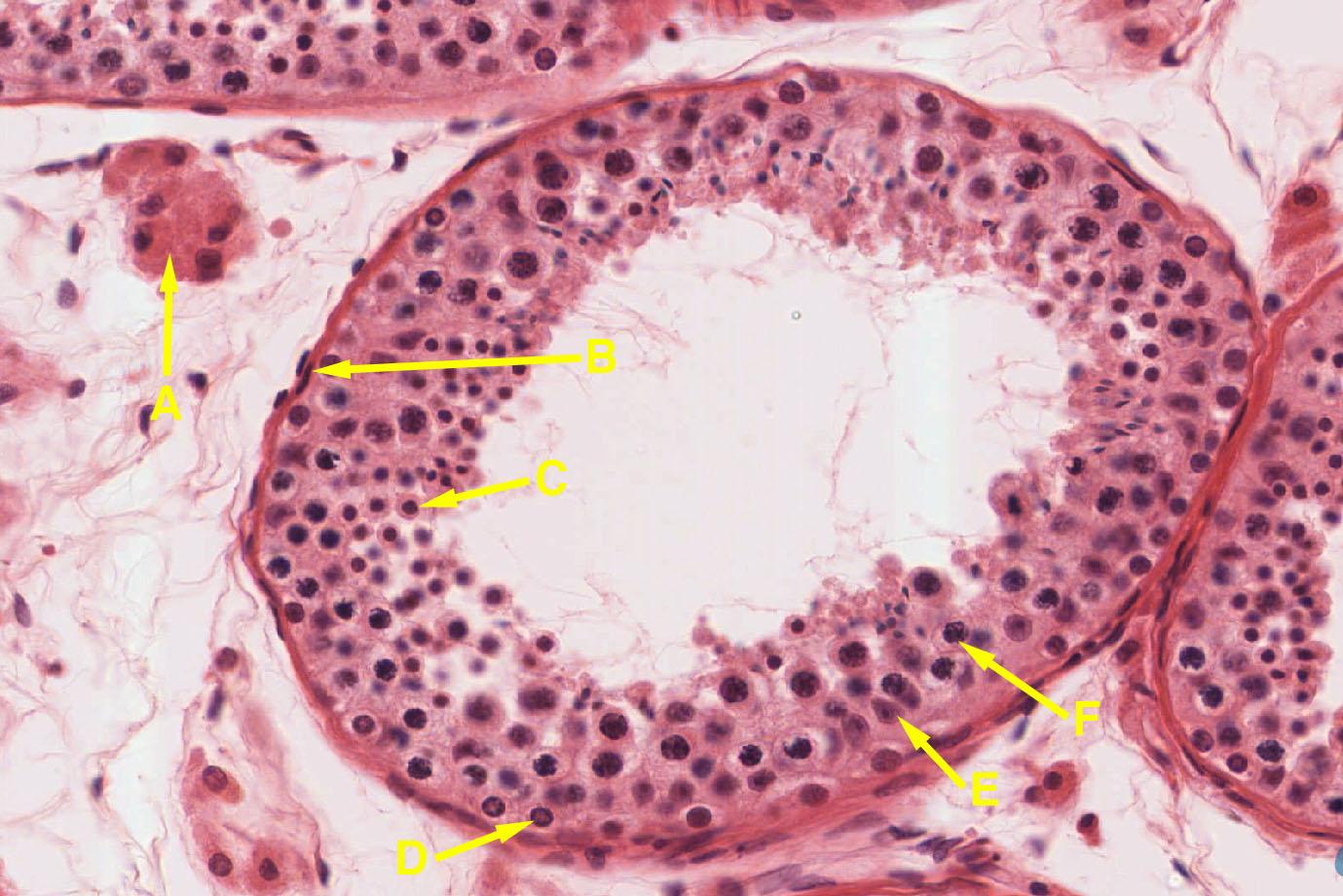 Solved 1. Identify the organ from which this slide was taken | Chegg.com