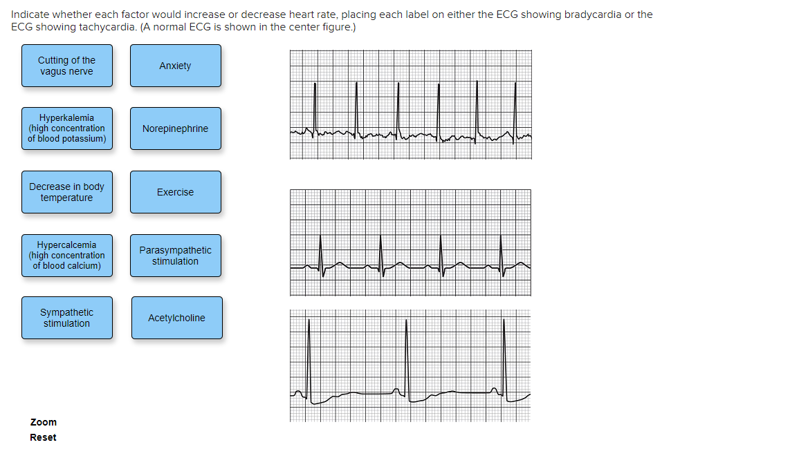 Solved Indicate whether each factor would increase or | Chegg.com