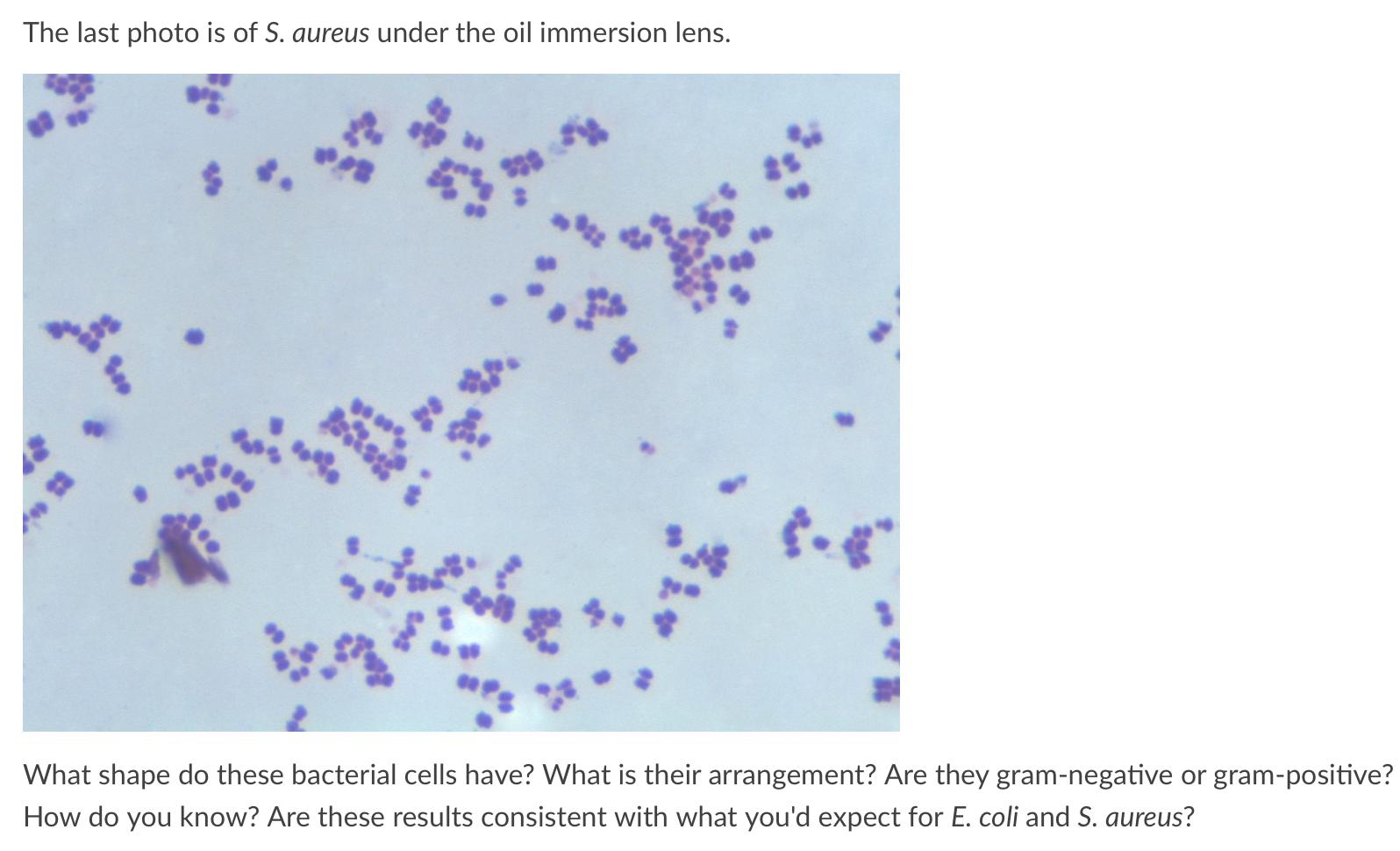 Solved The Last Photo Is Of S Aureus Under The Oil Immer Chegg Com