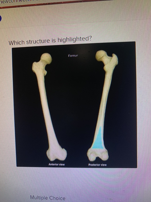 solved-ewcormecui-which-structure-is-highlighted-femur-chegg