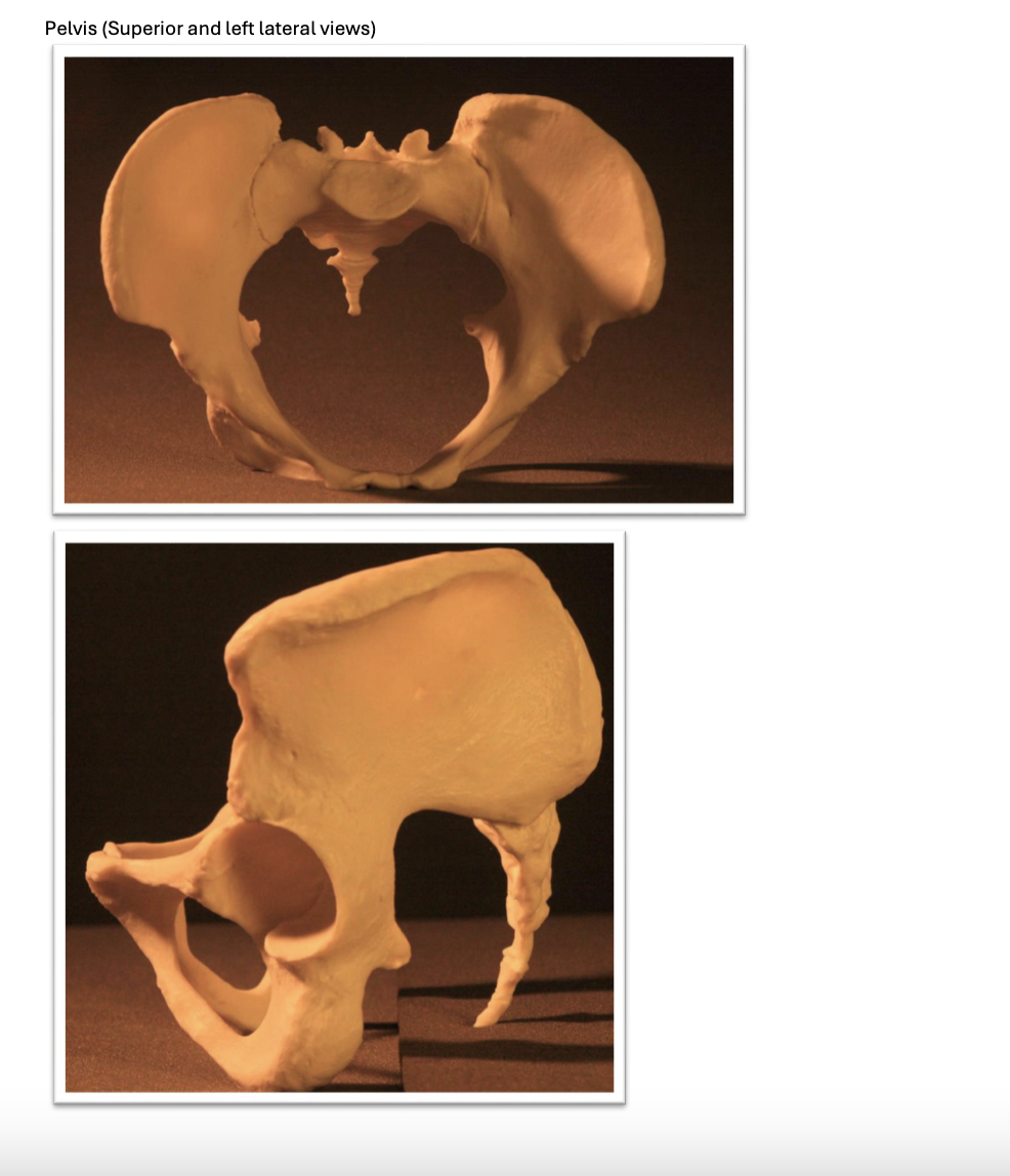 Solved Case CA-2714 - Skeletal Materials CA-2714 skull | Chegg.com