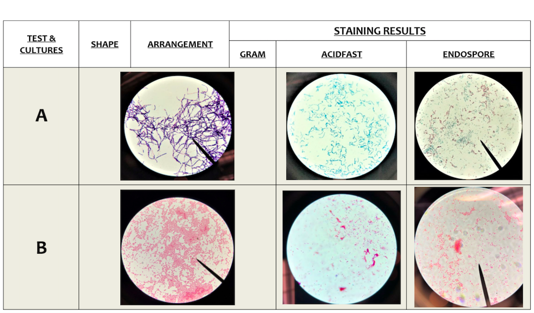 Solved Identify specimen A & B respectively with the