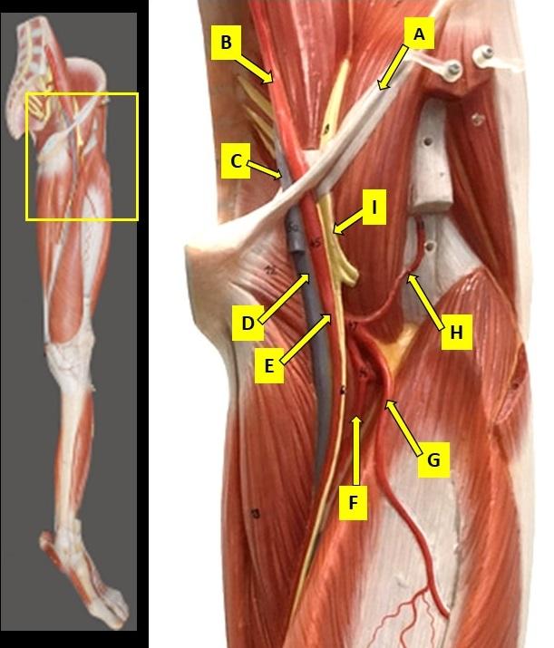 Help Me Match These Parts My Chooses Are Deep Chegg Com