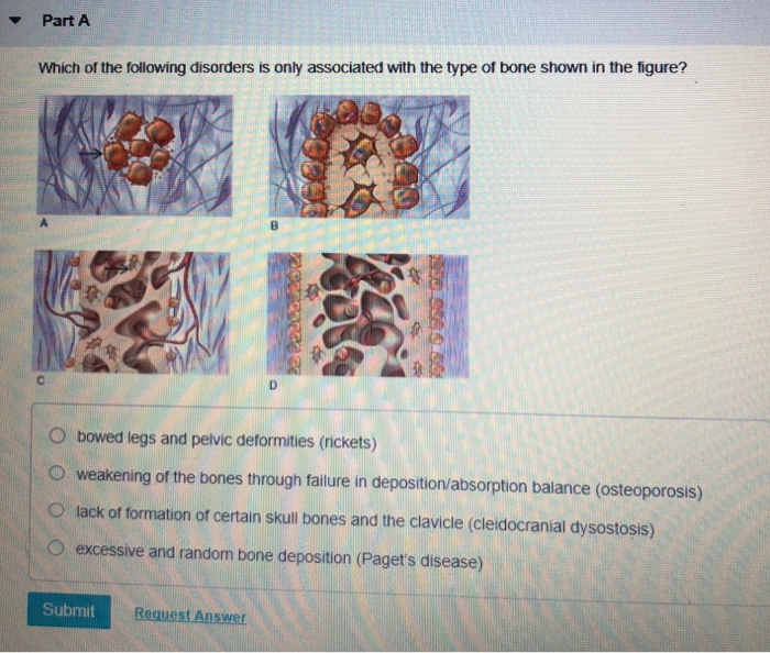 Solved Part A Which of the following disorders is only