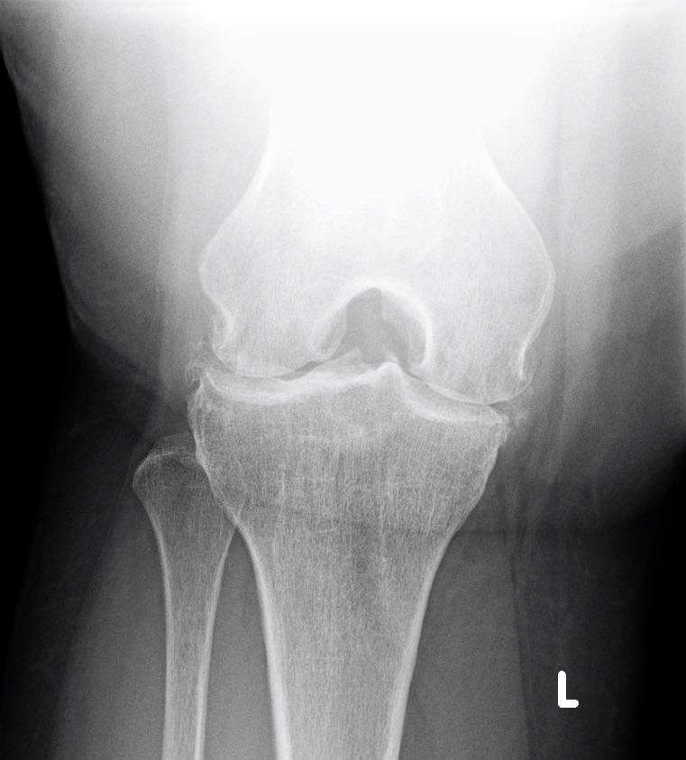 Solved 9.34 AM Thu Apr 6 Radiology Report PATIENT INITIALS: | Chegg.com