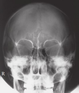 Solved do image critique using PACEMAN guideline for the | Chegg.com