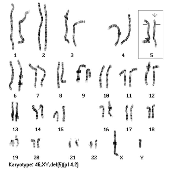 Solved With the following karyotype report provide the | Chegg.com