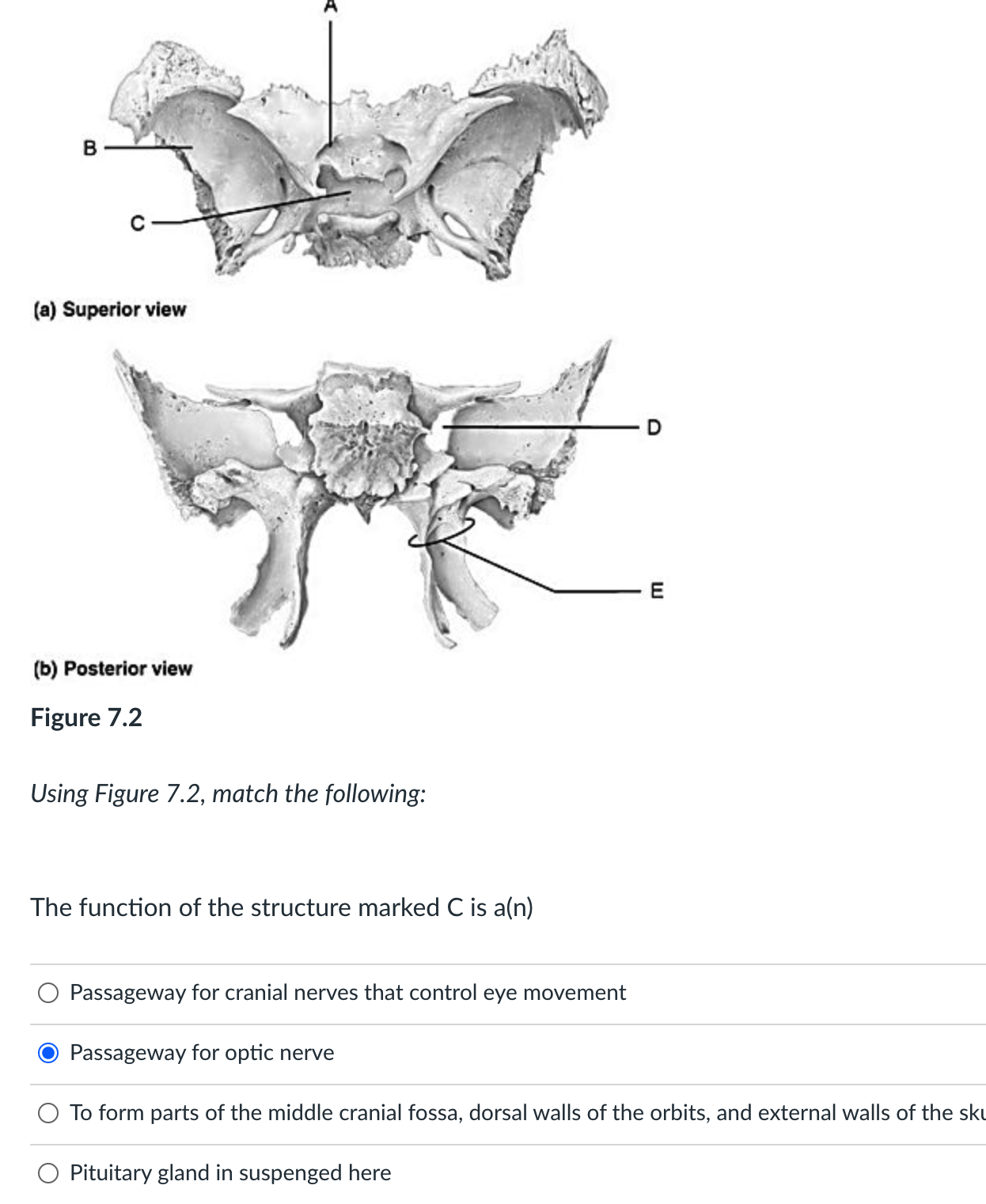 Solved B (a) Superior view E (b) Posterior view Figure 7.2
