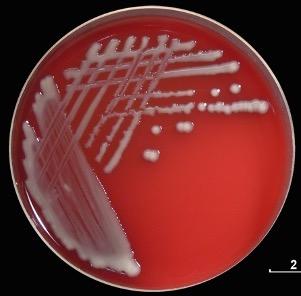 Solved Hello! I am in Microbiology this semester and my | Chegg.com