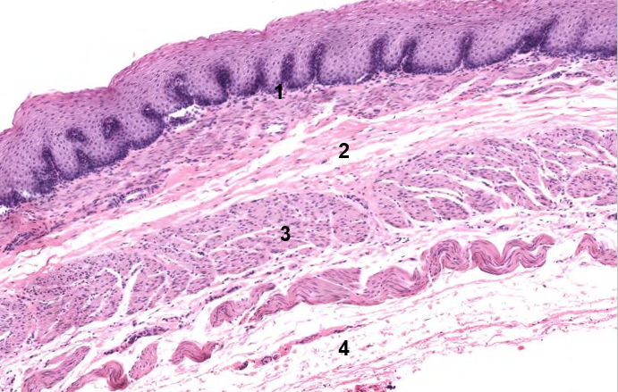 Solved Picture: digestive tract 1. what are the 4 basic | Chegg.com