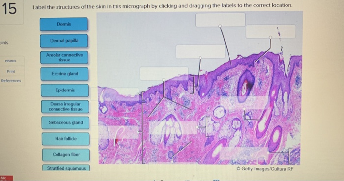 Solved: Label The Structures Of The Skin In This Micrograp... | Chegg.com