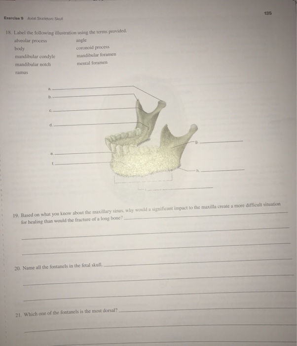 Solved 135 Exercise 9 Axial Skeleton Sku 18. Label The | Chegg.com