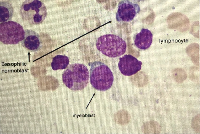 Basophilic Normoblast