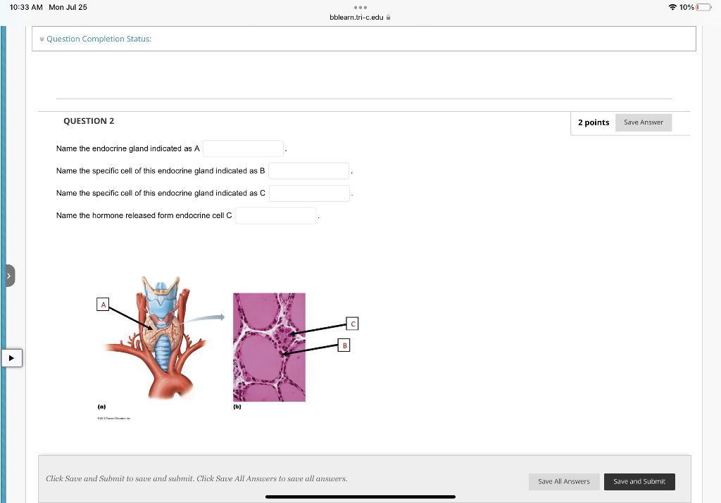 Solved Name the specific region of the diencephalon | Chegg.com