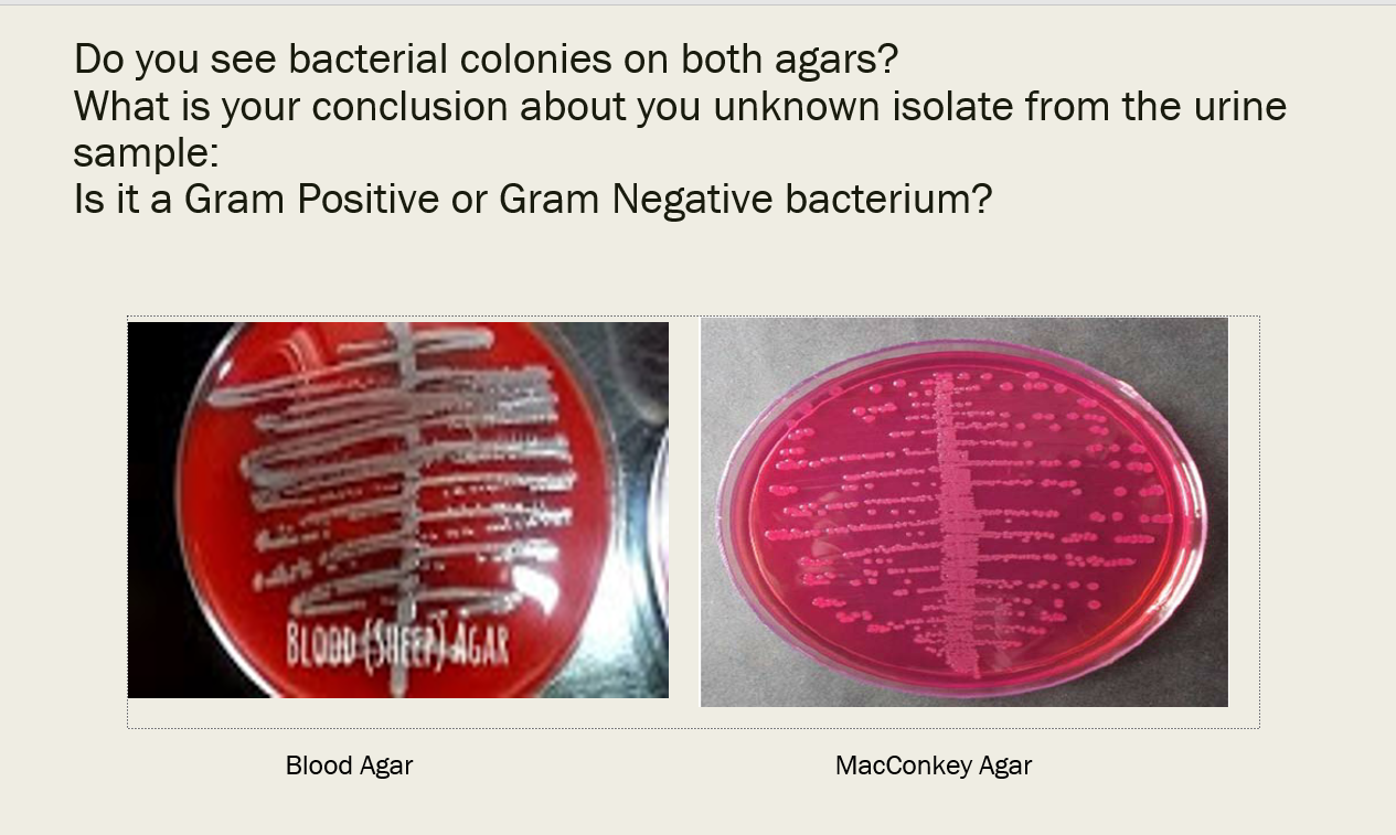 Solved Urine Culture To Diagnose Uti Caused By Gram Chegg Com
