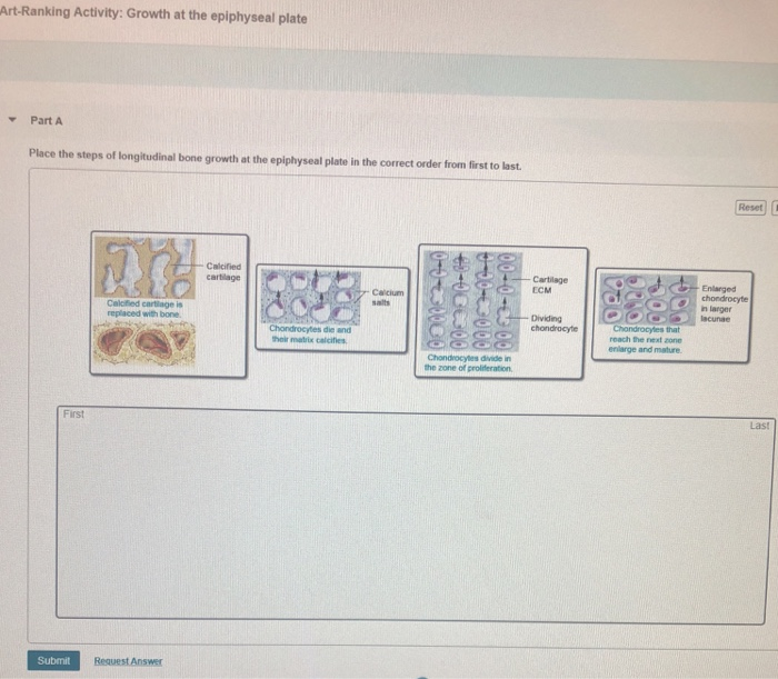 Solved Art-Ranking Activity: Growth at the epiphyseal plate | Chegg.com