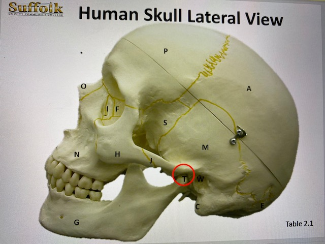 Solved Axial Skeleton Bones and Muscles Locate the various | Chegg.com