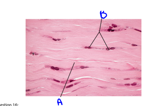 Solved This is______connective tissue. 
