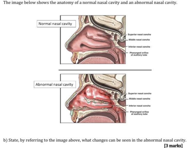 normal nasal passages