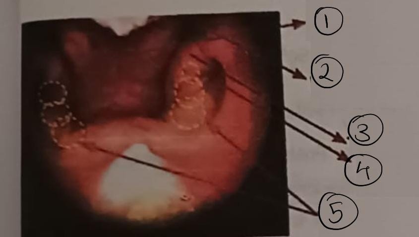 label the given endoscopy image correctly, and | Chegg.com