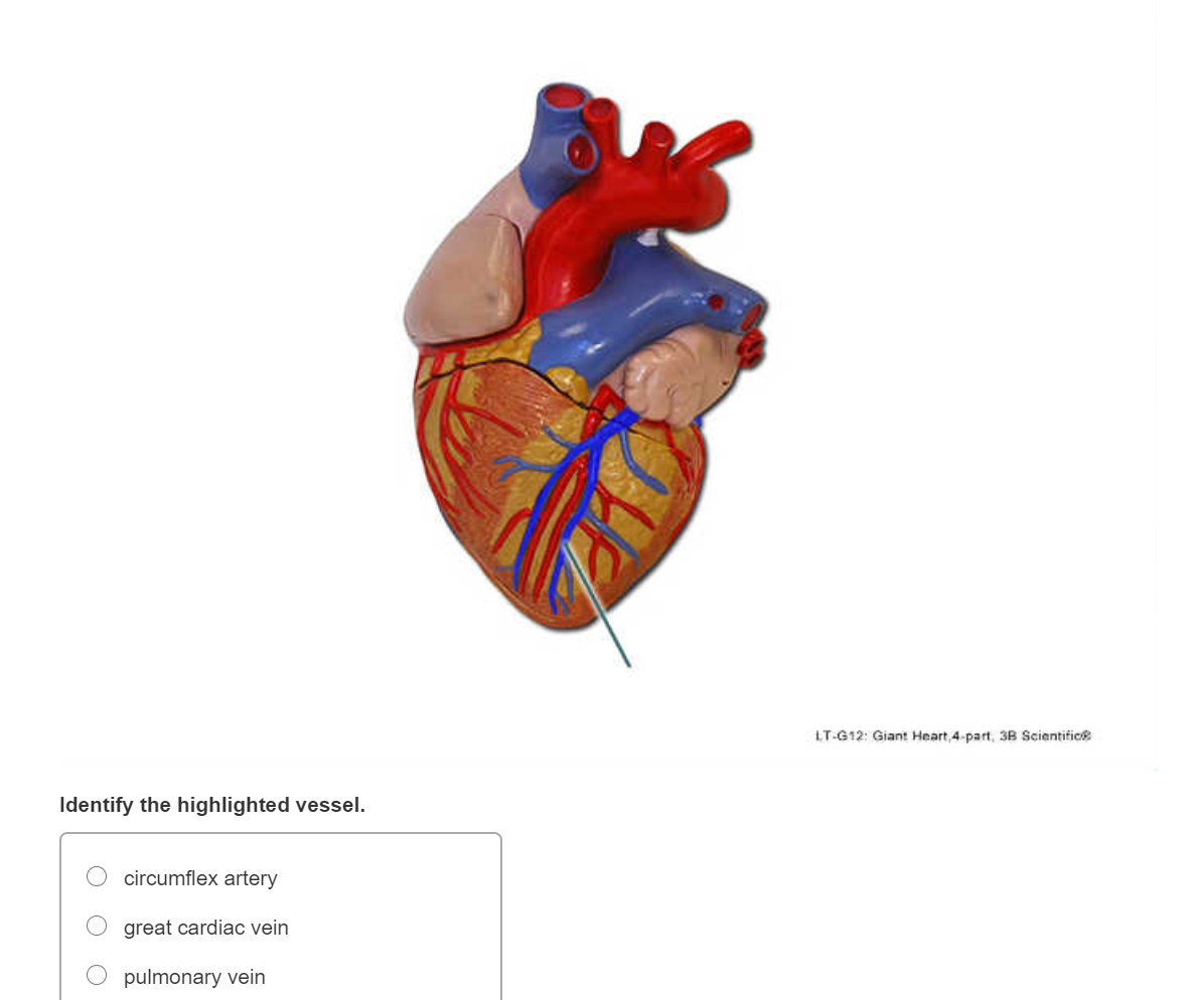 Solved LT-G12: Giant Heart, 4-part 3B Scientific Identify | Chegg.com