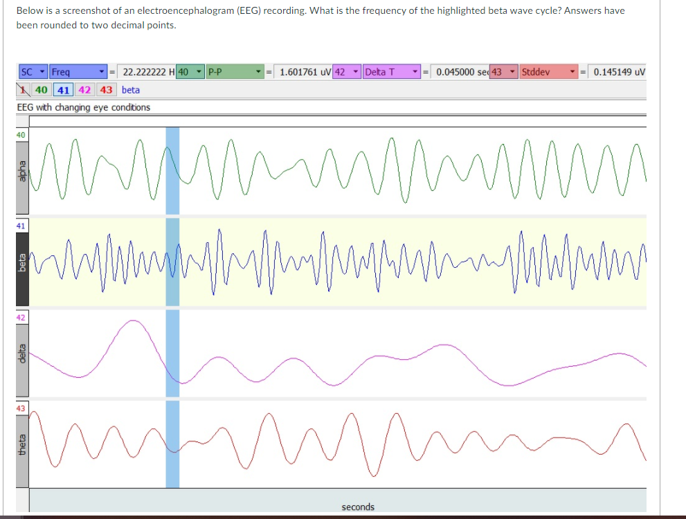 Solved Below Is A Screenshot Of An Electroencephalogram | Chegg.com