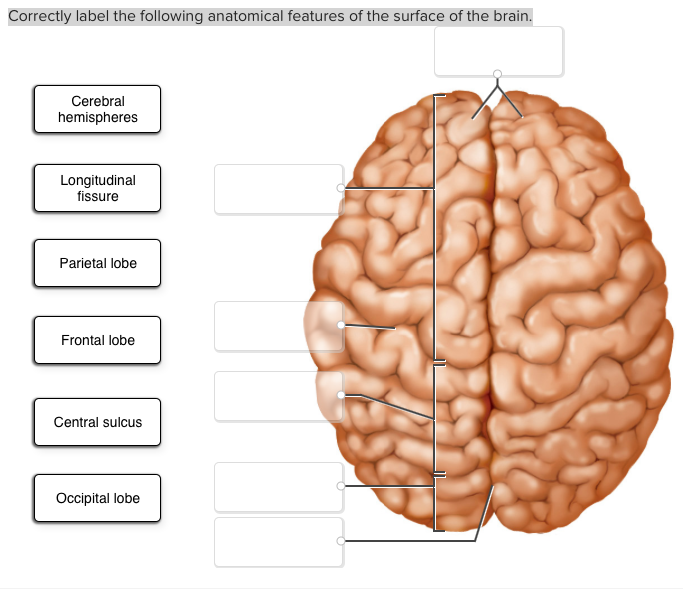 Solved Correctly label the following anatomical features of | Chegg.com