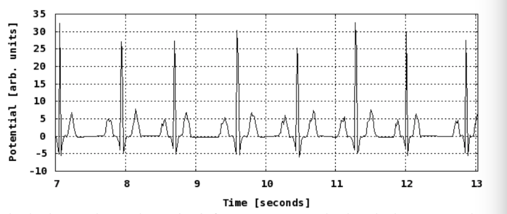 Solved The Plot Shows An Electrocardiogram (EKG) Of A | Chegg.com