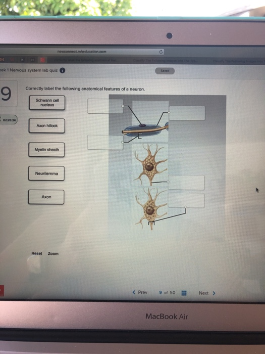 Solved: Ek 1 Nervous System Lab Quiz 9 Correctly Label The... | Chegg.com