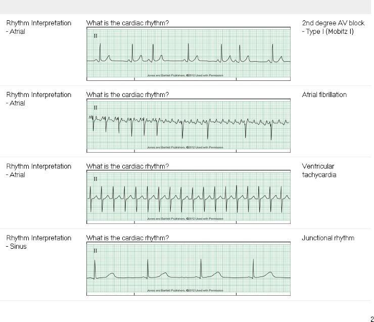 solved-i-need-help-with-these-ekg-rhythm-strips-for-the-chegg