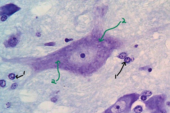 What Type Of Nervous System Tissue Is This? | Chegg.com