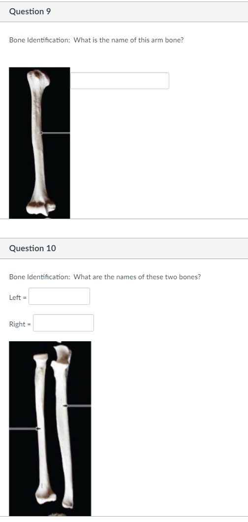 Solved Question 9 Bone Identification What is the name of