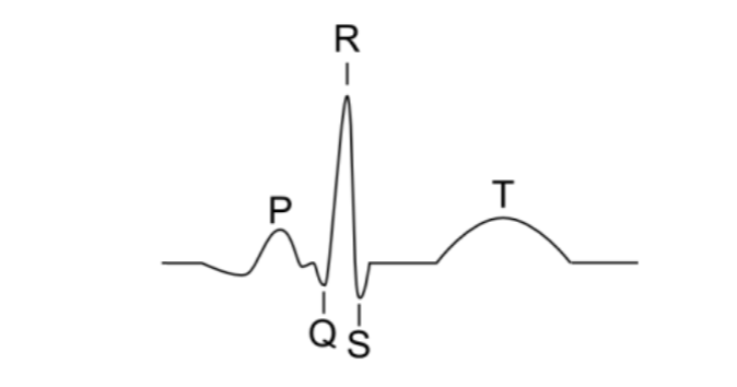 Solved The below picture represents an ECG | Chegg.com