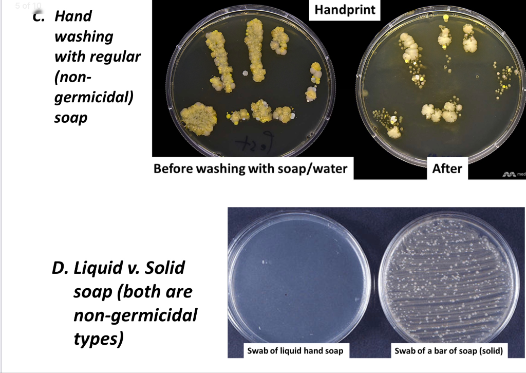 Solved Hand washing compare the results of handprints
