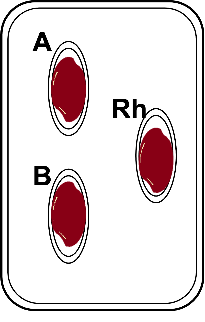 Solved A Rh В. A Rh B. A Rh B. ho | Chegg.com