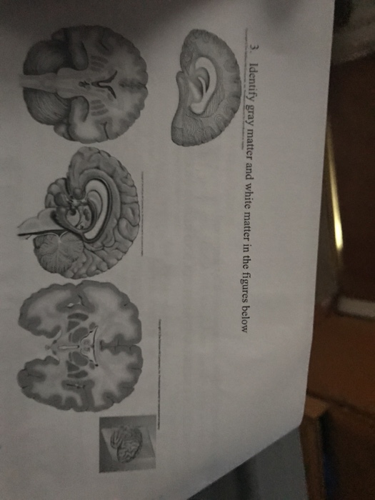 Solved 3. Identify gray matter and white matter in the | Chegg.com