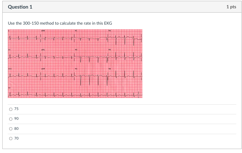 Question 1 1 Pts Use The 300 150 Method To Calculate Chegg Com